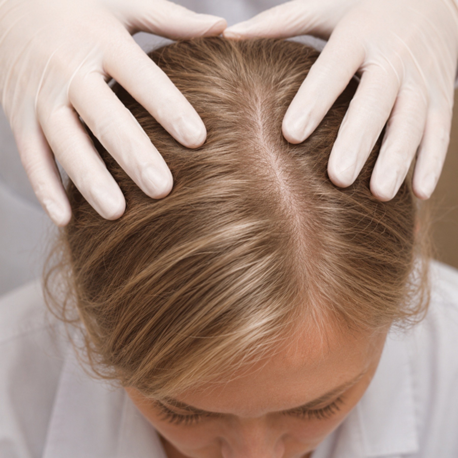 Close-up of a gloved scalp examination